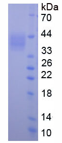 Active Dickkopf Related Protein 1 (DKK1)
