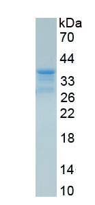 Active Epidermal Growth Factor Receptor (EGFR)