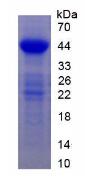 Active Epidermal Growth Factor Receptor (EGFR)