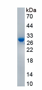 Active C Reactive Protein (CRP)