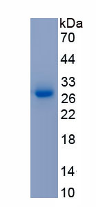 Active C Reactive Protein (CRP)