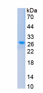 Active Prolactin (PRL)