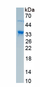 Active Tumor Protein p53 (P53)