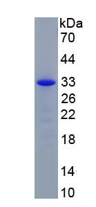 Active Tryptase (TPS)