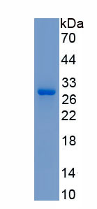 Active Glutathione S Transferase Kappa 1 (GSTk1)