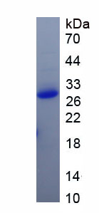 Active Nuclear Factor Kappa B2 (NFkB2)