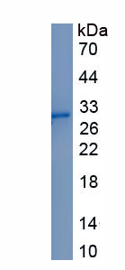 Active Tissue Factor Pathway Inhibitor 2 (TFPI2)