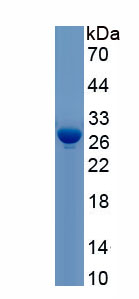 Active Interleukin 34 (IL34)