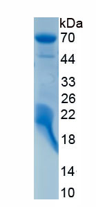 Active Histone Deacetylase 1 (HDAC1)