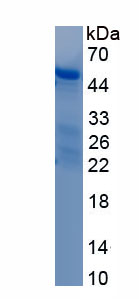 Active E1A Binding Protein P300 (EP300)