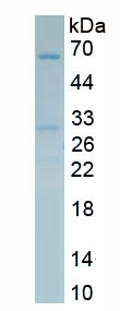 Active Carboxylesterase 1 (CES1)