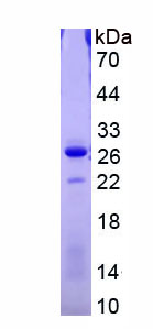 Active Cathelicidin Antimicrobial Peptide (CAMP)