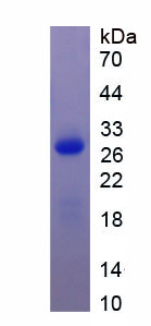 Active Stromal Interaction Molecule 1 (STIM1)