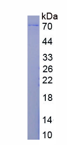 Active Asparaginyl tRNA Synthetase (NARS)