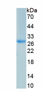 Active Fibulin 2 (FBLN2)