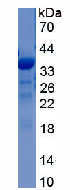 Active Lipase, Monoacylglycerol (MGL)