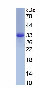 Active Glycogen Synthase Kinase 3 Beta (GSK3b)