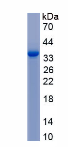 Active Hexokinase 2 (HK2)