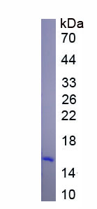 Active Diazepam Binding Inhibitor (DBI)