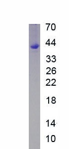 Active Procollagen Lysine-2-Oxoglutarate-5-Dioxygenase 2 (PLOD2)