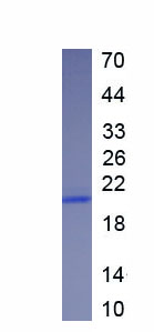 Active Leukocyte Cell Derived Chemotaxin 2 (LECT2)