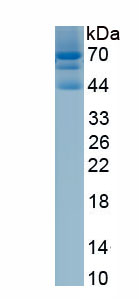 Active Sex Determining Region Y Box Protein 9 (SOX9)