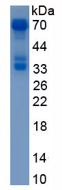 Active Sex Determining Region Y Box Protein 9 (SOX9)