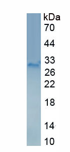 Active Cholesterol-25-Hydroxylase (CH25H)