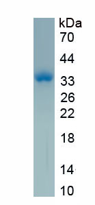 Active Palmitoyl Protein Thioesterase 1 (PPT1)