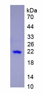 Active Stress Induced Phosphoprotein 1 (STIP1)