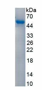 Active Uracil Phosphoribosyltransferase (UPRT)