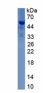 Active Homeobox Protein D11 (HOXD11)