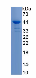 Active Homeobox Protein A13 (HOXA13)