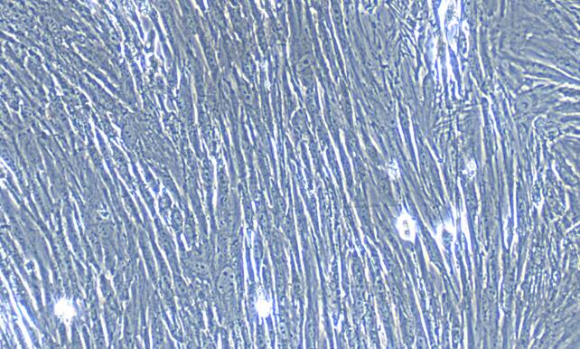 Primary Human Umbilical Mesenchymal Stem Cells (UMSC)