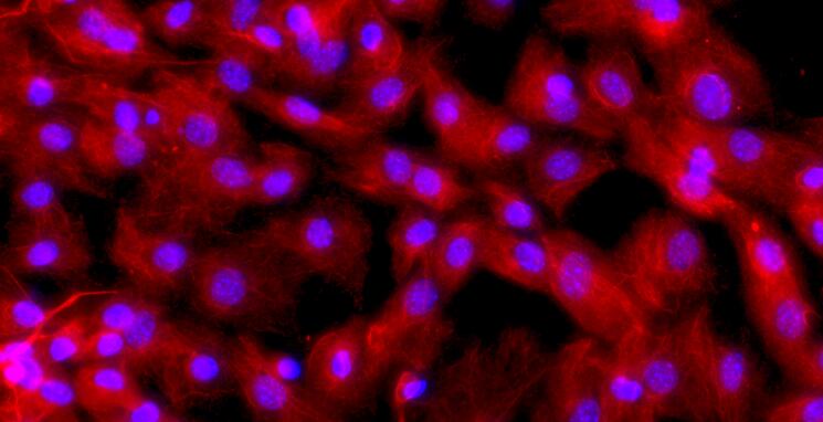 Primary Mouse Pulmonary Microvascular Endothelial Cells (PMEC)