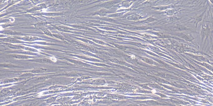 Primary Human Subcutaneous Preadipocytes (SPrAD)