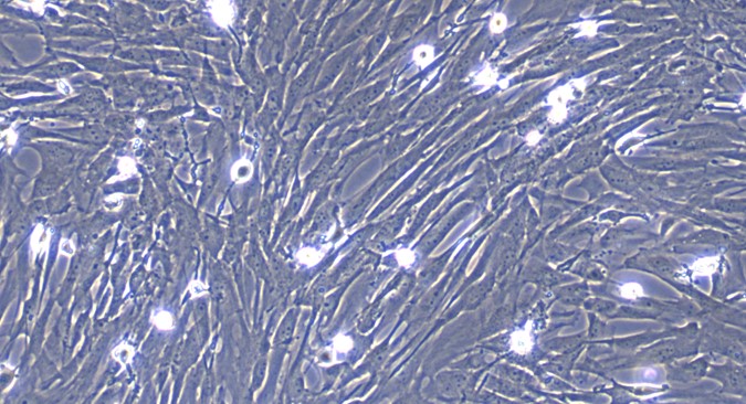 Primary Canine Choroid Plexus Fibroblasts (CPF)