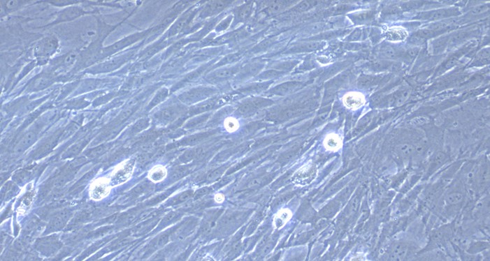 Primary Rabbit Choroid Plexus Fibroblasts (CPF)