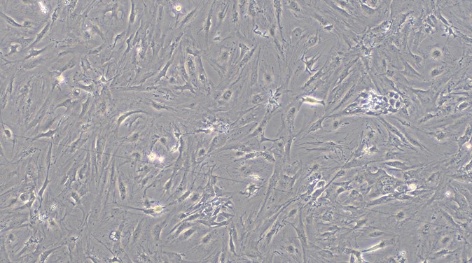 Primary Mouse Bladder Smooth Muscle Cells (BSMC)