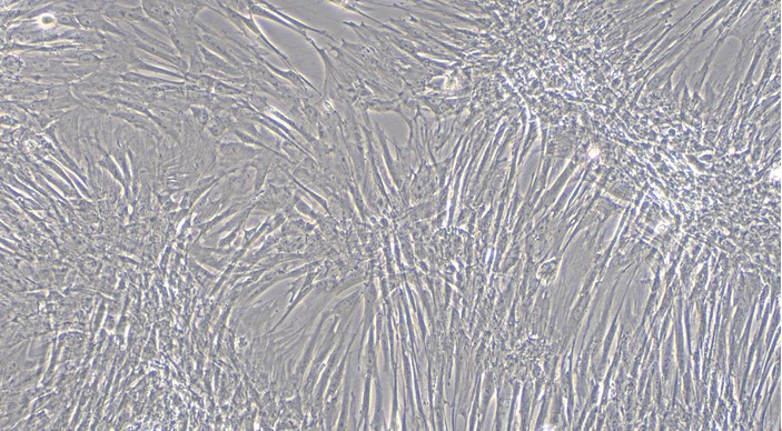 Primary Feline Bladder Stromal Fibroblasts (BSF)