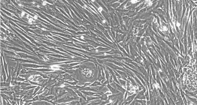Primary Porcine Tracheal Smooth Muscle Cells (TSMC)