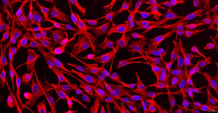 Primary Rabbit Intestinal Fibroblasts (IF)