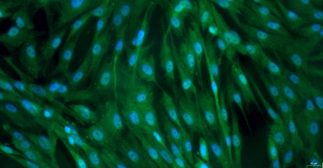 Primary Feline Adult Epidermal Keratinocytes (AEK)