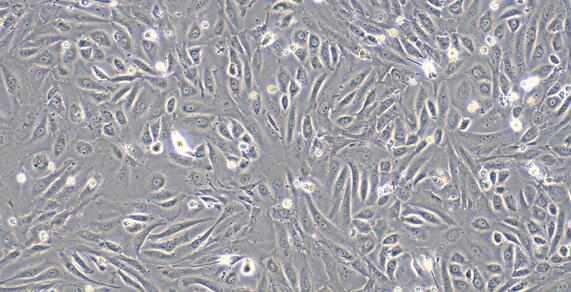 Primary Mouse Dermal Lymphatic Endothelial Cells (DLEC)