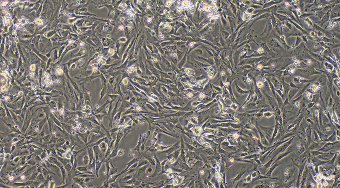 Primary Mouse Fetal Dermal Fibroblasts (FDF)