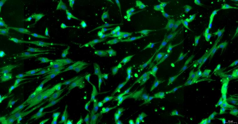 Primary Human Periodontal Ligament Fibroblasts (PDLF)