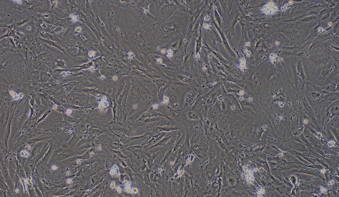 Primary Rat Adrenal Fibroblasts (ADF)