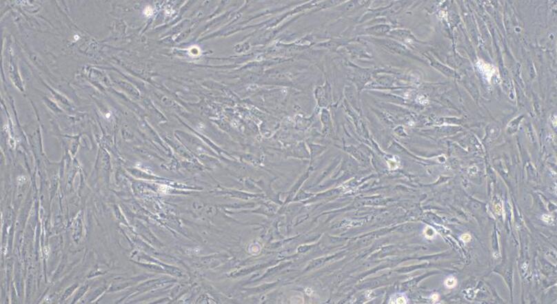 Primary Mouse Mammary Fibroblasts (MF)