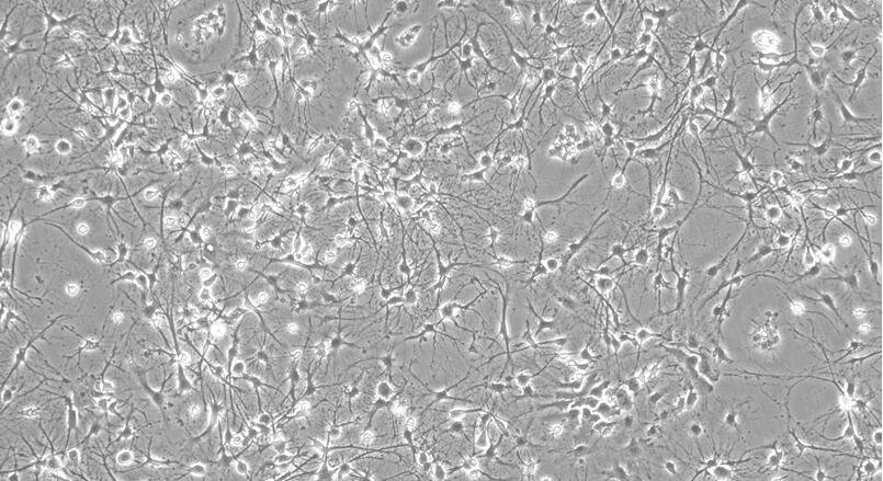 Primary Rat Hippocampal Neuron Cells  (HNC)