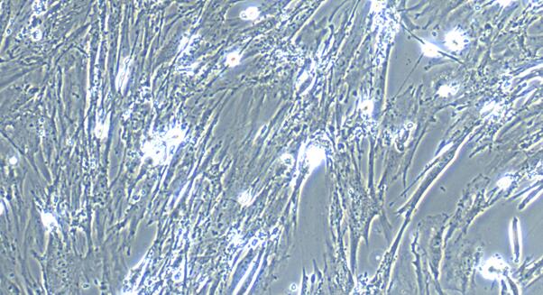 Primary Mouse Gastric Smooth Muscle Cells (GSMC)